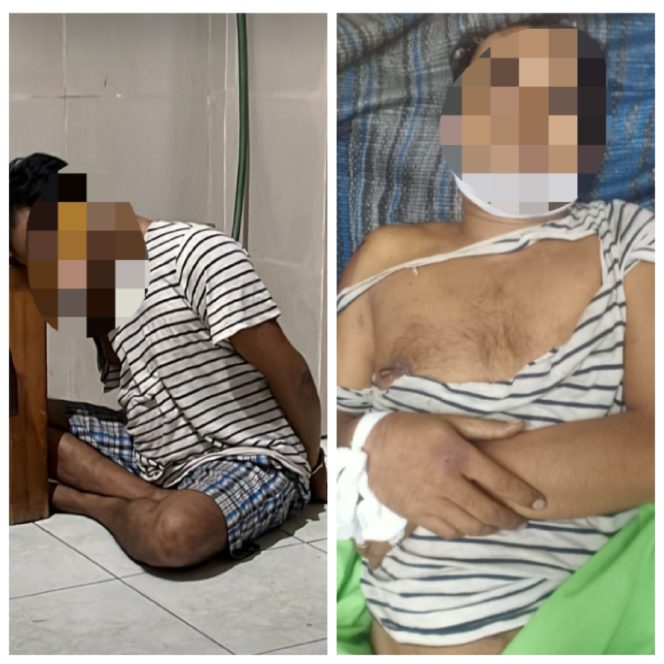 
 Terduga Pelaku Curanmor Meninggal Secara Misterius Usai Diamankan Polsek Simokerto